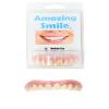 Amazing Smile Veneers (Medium) view 1