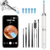 Ear Wax Removal, Ear Cleaner with Camera and Light, Ear Wax Removal Kit with 1296P Otoscope, Ear Cleaning Tool with 6 Ear Spoon, Ear Camera for iPhone & Android Phones,White view 1