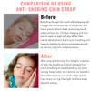 Orapink Anti-Snoring Chin Strap, Small Size Chin Strap for Snoring, Reduce Snoring - Breathable Anti Snoring Device, Sleep Aid Solution Flexible Adjustable Face Slimmer view 2