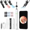 Bebird Pro Note5 Ear Picker with Camera Tweezers, Wireless Wax Removal Tool Camera Cleaner Otoscope with Light for iPhone, Visual Ear Viewing Scope with Videos, WiFi Cleaning Kit for Adults & Kids view 1