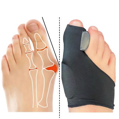 2 Pairs Bunion Corrector Sock - 2023 New Orthoes Bunion Relief Socks Women Men, Comfortable Orthopedic Bunion Toe Corrector Big Toe Straightener Brace, Hallux Valgus Corrector Bunion Pads (Black)