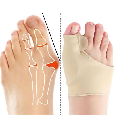 2 Pairs Bunion Corrector Sock - 2023 New Orthoes Bunion Relief Socks Women  Men, Comfortable Orthopedic Bunion Toe Corrector Big Toe Straightener Brace, Hallux Valgus Corrector Bunion Pads (Beige)
