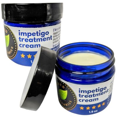 Tamed Organics Impetigo Symptom Relief Cream 2 Large 1.9 oz Jars of Fast Acting Safe Natural Formula Dries Impetigo Sores, Anti Itching & Anti Scarring. Adult Children Crema Ointment 3.8 Total oz