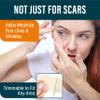 NUVADERMIS Clear Silicone Scar Tape for Surgical Scars - 120" x 1.5" Roll - Extra Long Scar Sheets for C-Section, Tummy Tuck, Keloid, and Surgical Scars - Reusable Medical Grade Silicone Scar Tape view 2