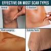 NUVADERMIS Clear Silicone Scar Tape for Surgical Scars - 120" x 1.5" Roll - Extra Long Scar Sheets for C-Section, Tummy Tuck, Keloid, and Surgical Scars - Reusable Medical Grade Silicone Scar Tape view 4