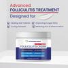Folliculitis Treatment Cream, Extra Strength Folliculitis Scalp Treatment, Antifungal Cream, Psoriasis Cream, Fast Effective Treatment for Folliculitis, Psoriasis & Seborrheic Dermatitis,Itch Relief view 2