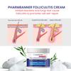 Folliculitis Treatment Cream, Extra Strength Folliculitis Scalp Treatment, Antifungal Cream, Psoriasis Cream, Fast Effective Treatment for Folliculitis, Psoriasis & Seborrheic Dermatitis,Itch Relief view 3