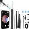 Baddie NE3 Ear Cleaner Otoscope Ear Wax Removal Tool with Camera and LED Light Wireless Ear Endoscope Ear Cleaning Kit (Black) view 1