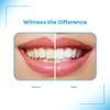 ALIGNERCO White Foam On-The-Go Clear Retainer Cleaner. Eliminates Bacteria, Whitens Teeth & Fights Bad Breath view 4