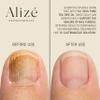 Aliz Aromatherapy Organic Tea Tree Essential Oil, USDA Certified Organic 100% Natural & Pure Essential Oils for Diffusers for Home, Aromatherapy Oils, Diffuser Oils Scents, Cleansing, 10ml-0.33 fl oz view 3