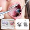 Braces Kit - 200pcs/Box Bondable Metal Brackets For Teeth 0.022 Slot With 3 Hook (Standard MBT) view 3