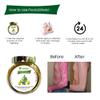 Ancient Herbs of India Danda Thuhar Psoriasis Oil for Psoriasis, Eczema and itching view 2