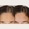 Solaris Laboratories NY Cloud Nine Hair Density and Boosting Stimulating Scalp Massager view 2