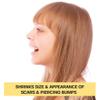 BASE LABORATORIES Piercing Keloid Bumps Shrinking Duo | Piercing Bump Treatment (.5oz) + Keloid Bump Removal Gel (2oz) | Keloid Scar Removal for all Scars, Keloids & Piercing Bumps view 2