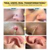 BASE LABORATORIES Piercing Keloid Bumps Shrinking Duo | Piercing Bump Treatment (.5oz) + Keloid Bump Removal Gel (2oz) | Keloid Scar Removal for all Scars, Keloids & Piercing Bumps view 4
