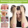 LMNOOP Psoriasis Cream, Maximum Strength Treatment Moisturizing Cream for Psoriasis, Dermatitis, Rash, Anti-Itch, Redness, Flaking, Scaling, Fast Acting Relief for Irritated, Dry Skin view 2
