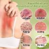 LMNOOP Psoriasis Cream, Maximum Strength Treatment Moisturizing Cream for Psoriasis, Dermatitis, Rash, Anti-Itch, Redness, Flaking, Scaling, Fast Acting Relief for Irritated, Dry Skin view 3