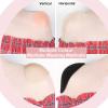 4Pairs Removable Silicone Shoulder Pads - Soft Self Adhesive Push Up Pads to Prevent Slippage for Women and Men view 3