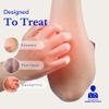 Theraplex Eczema Treatment Bundle - AIM Itching Cream (3 Oz) & Eczema Therapy (6 Oz) for Itch Relief - Strongest Anti Itch Cream & Moisturizer - for Itchy Skin Treatment view 2