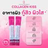 Collagen kiss view 3