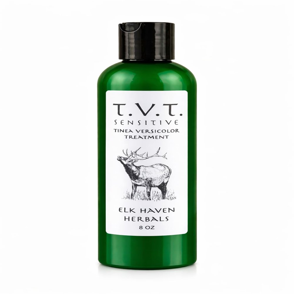 Elk Haven Herbals T.V.T. Sensitive - Tinea Versicolor Treatment and Cure for Sensitive Skin (8 oz)