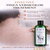 Elk Haven Herbals T.V.T. Sensitive - Tinea Versicolor Treatment and Cure for Sensitive Skin (8 oz) view 2