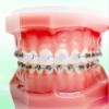 AmeriCan Goods 5 Pack Orthodontic Wax for Braces Unflavoured Natural with Vitamin E and Aloe Vera Comfort Covers for Braces view 4