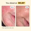 MyMagicHealer Universal Flare Care | Essential Oil Free | Baby Dermatitis, Diaper Rash, Eczema, Psoriasis, Impetigo | Wound Care | Multi-purpose Solution for Sensitive Skin w/ Propolis & Egg Yolk 4 oz view 3