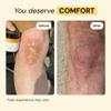 MyMagicHealer Universal Flare Care | Essential Oil Free | Baby Dermatitis, Diaper Rash, Eczema, Psoriasis, Impetigo | Wound Care | Multi-purpose Solution for Sensitive Skin w/ Propolis & Egg Yolk 4 oz view 4
