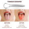 AILE Tongue Scraper, 100% Useful Surgical Stainless Steel Tongue Cleaner for Both Adults and Kids, Professional Reduce Bad Breath Metal Tongue Scrapers, Help Your Oral Hygiene" view 4
