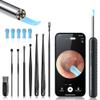 Argo Well Ear Wax Removal Kit with 1080P Camera - 360 HD Ear Cleaner for iOS/Android, 6 LED Lights, Soft Silicone Picks, IP67 Waterproof, Rechargeable, WiFi-Enabled Ear Care Set with 8 Tools view 1