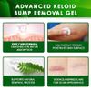 Advanced Keloid Bump Removal Gel: Silicone Keloid Scar Removal Cream for Scars from Piercing, Surgical Marks, Acne, and Burns, Keloid Treatment for Ears, Face, and Body with Healing Formula 30g view 4
