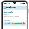 Prolactin Test for Women  Essential for Assessing Reproductive Health  Convenient Home Testing  Analysis by CLIA-Certified Lab  Verisana view 2
