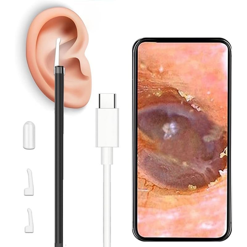 Auttoop Endoscope Type-C high-definition visible ear spoon Ear cleaner, ear scope, ear scoop, ear picking tool, and divine tool