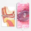 Auttoop Endoscope Type-C high-definition visible ear spoon Ear cleaner, ear scope, ear scoop, ear picking tool, and divine tool view 3
