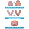 DENTUREWAY DIY Denture Kit with Impression, Do-It-Yourself Partial Denture Solution, Small view 4