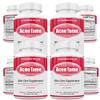 Acnetame Acne Pills Supplement- Clear Skin Vitamins Pill for Oily Skin Treatment, Hormonal Blemishes, Anti Spots & Cystic Acnes Supplements for Women, Men, Teens & Adults- 240 Oral Tablets view 1