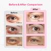 4PCS Gel Eye Ice Pack Set Reusable, Cold and Hot Compress for Eyes, Ice Pack for Eyes, Cooling Eye Pads for Eye Strain, Swelling, Redness, Dark Circles, Puffy Eyes, and Eye Recovery Surgery. view 3