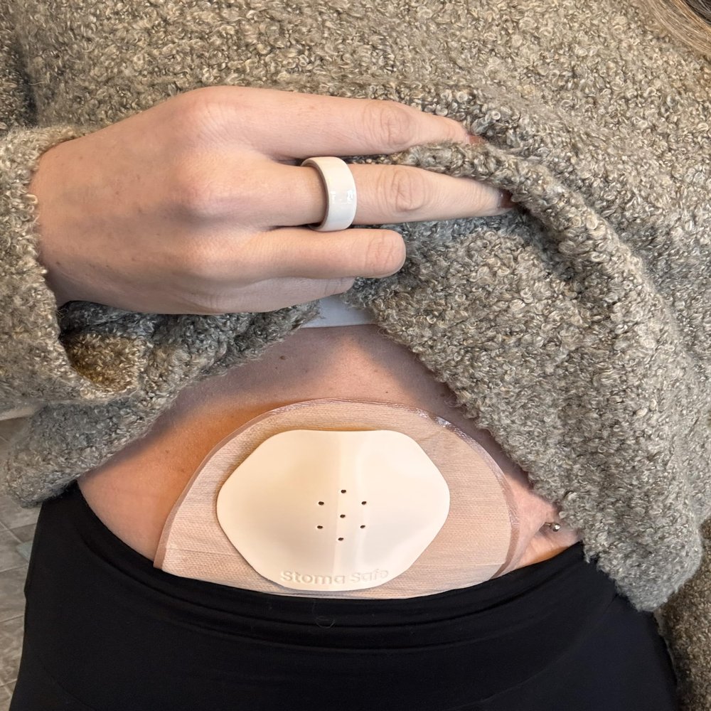 Stoma Safe | Stoma Protector | Stoma Shield | Ostomy Protector | Hernia Protector | Ostomy Bag