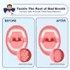 Electronic Tonsil Stone Remover Vacuum, Tonsil Stone Removal Kit with 3 Suction Modes, Include Oral lamp, Oral Irrigator, 5X Magnifying Mirror, Instant Suction Tonsil Stone Removal Tool (Green) view 2
