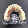 HENLYEN Dental Typodont Model Implant Restoration Tooth Model, Maxillary Implant Study Analysis Demonstration Teeth Model with Removable Teeth and Soft Gum for Study Teaching. , Skin view 3