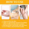 Drawing ointment cream for boils, Cyst Removal Patch, Splinter Removal, Bug, Mosquito, Spider Bites, Bee Sting, Boils Ease, Chigger, Carbuncle, Pilonidal, Sebaceous, Inner Thigh, Itching Relief view 3