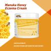 SIONPPGET Organic Natural Bee Venom Extra Eczema Ointment, Relief Anti-Itch, Red Rash Cream, Gentle Plant Added, Soothing Psoriasis, Jock Itch, Irritated Skin, for Dry Sensitive, Feet, Hand Skin view 2