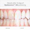 Opalescence 35% Gel Syringes Teeth Whitening - Refill Kit (12 Syringes Total) Carbamide Peroxide. Made by Ultradent, in Melon Flavor. Tooth Whitening Refill Syringes 5404-6 view 2