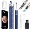 CozyZen Ear Wax Removal Tool S5 with 10 MP Camera Otoscope, Omnidirectional Tweezer, Crodless Earwax Remover Tool with 12 Ear Spoon, Wireless Ear Cleaner with Light for iOS & Android (Blue) view 1