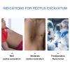 HMWOKPOT Pectus Excavatum Funnel Chest Brace, Thoracic Depression Brace Correction Principle of Pectus Excavatum for Kids Men Women,15cm view 4