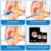 Ear Wax Removal - Ear Cleaner - Ear Camera - FSA HSA Eligible - Ear Wax Removal Kit - Ear Wax Removal Tool Camera - 1080HD Effective for Cleaning Ear Wax Build-Up view 4