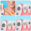 AmeriCan Goods Dental Floss Threaders Flexible Nylon Smooth Edges Orthodontic Floss Threader for Braces, Bridges, Implants (250) view 4