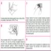 LifeSign Uricult CLED/EMB Urinary Tract Infection Detection, in-Office Medium Culture Biplate System (10 Tests/Box) view 3
