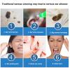 Comprehensive Ear Kit - 500ml Ear Washing Brand Newwith SilicTube & Spray Nozzle for Home Use view 2